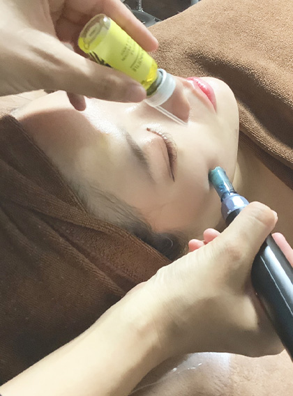 【新規限定】<br>レモンボトル2cc＋ラジオ波＋炭酸ケア