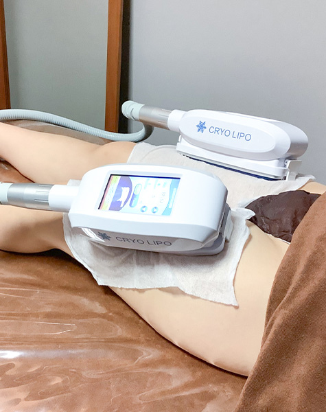 脂肪冷却2カップ（時間短め）