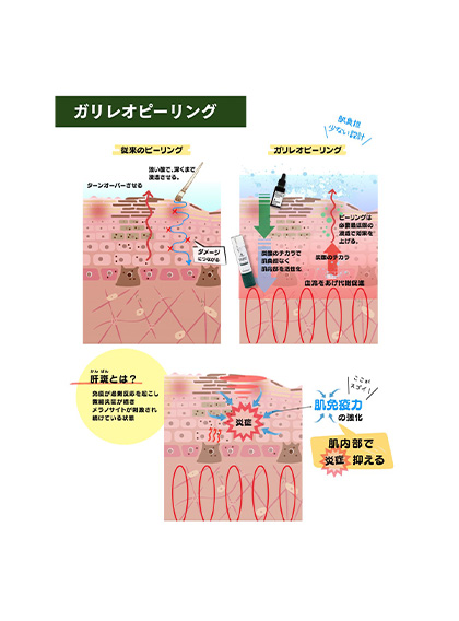 ガリレオピール（剥けないハーブ）