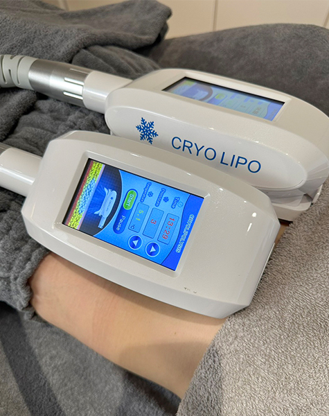 脂肪冷却痩身（1部位1パーツ）