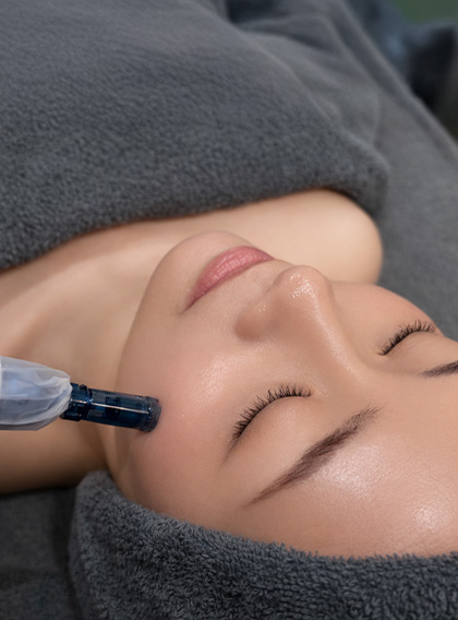 マイクロニードルセラピー（お肌）